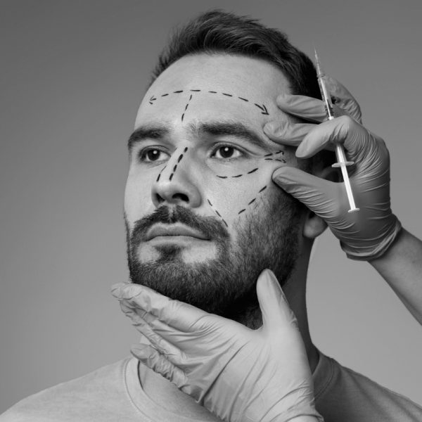 remodelacion facial hombre